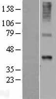 NBL1-17877 - Wnt7b Lysate