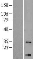 NBL1-17900 - XBP1 Lysate
