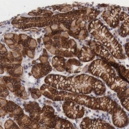 NBP1-89030 - XPNPEP3