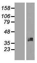 NBL1-17914 - XRCC2 Lysate