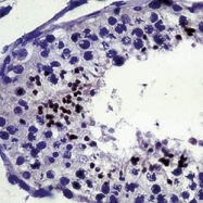 NB120-2367 - XRCC2