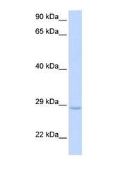 NBP1-58119 - XRCC2