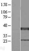 NBL1-17915 - XRCC3 Lysate
