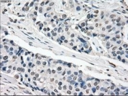 NBP1-48053 - XRCC4