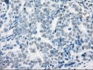 NBP1-48053 - XRCC4