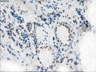 NBP1-48053 - XRCC4