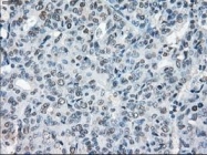 NBP1-48053 - XRCC4