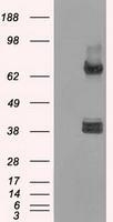 NBP1-48053 - XRCC4