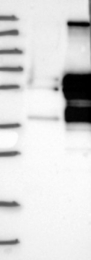 NBP1-89463 - XRCC4