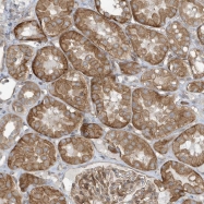 NBP1-81339 - XRCC6BP1 / KUBP