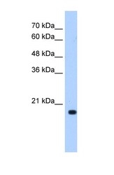 NBP1-55335 - XTP3TPA / DCTPP1