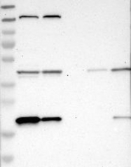 NBP1-85736 - XTP3TPA / DCTPP1