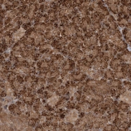 NBP1-89420 - XRN1 / SEP1