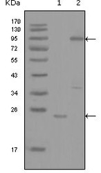 NBP1-47520 - YES1