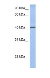 NBP1-70750 - YIPF1