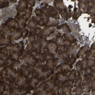 NBP1-83590 - YSK4