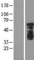 NBL1-17943 - YTHD1 Lysate