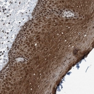 NBP1-81353 - YTHDC1