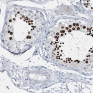 NBP1-81354 - YTHDC1
