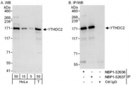 NBP1-52636 - YTHDC2