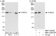 NBP1-52637 - YTHDC2