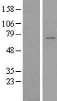 NBL1-17944 - YTHDF2 Lysate