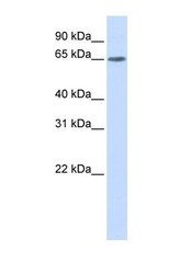 NBP1-56303 - YTHDF3