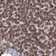 NBP1-90060 - ZA20D3