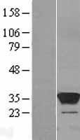 NBL1-18015 - ZA20D3 Lysate