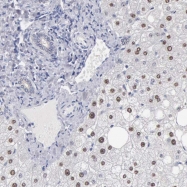 NBP1-92602 - ZADH1