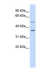 NBP1-55192 - ZADH1