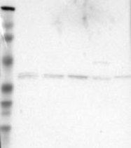 NBP1-92602 - ZADH1