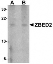 NBP1-77349 - ZBED2