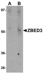 NBP1-76326 - ZBED3