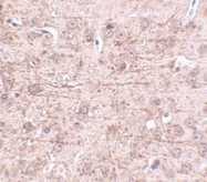 NBP1-76970 - ZBTB1