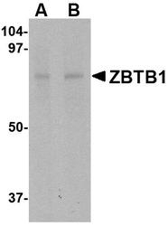 NBP1-76970 - ZBTB1