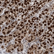 NBP1-80580 - ZBTB11