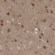 NBP1-80581 - ZBTB11