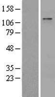 NBL1-17962 - ZBTB11 Lysate