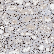 NBP1-84146 - ZBTB20