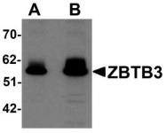 NBP1-76516 - ZBTB3