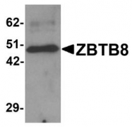 NBP1-76521 - ZBTB8