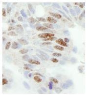 NB100-74651 - ZC3H11A