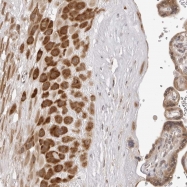 NBP1-82973 - ZC3H11A