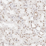 NBP1-82975 - ZC3H11A