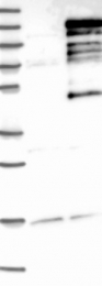 NBP1-82973 - ZC3H11A