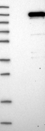 NBP1-82974 - ZC3H11A