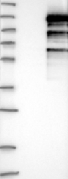 NBP1-82975 - ZC3H11A