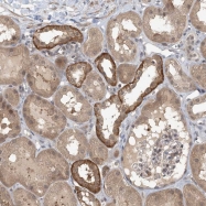 NBP1-83587 - ZC3H12A