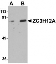 NBP1-76258 - ZC3H12A